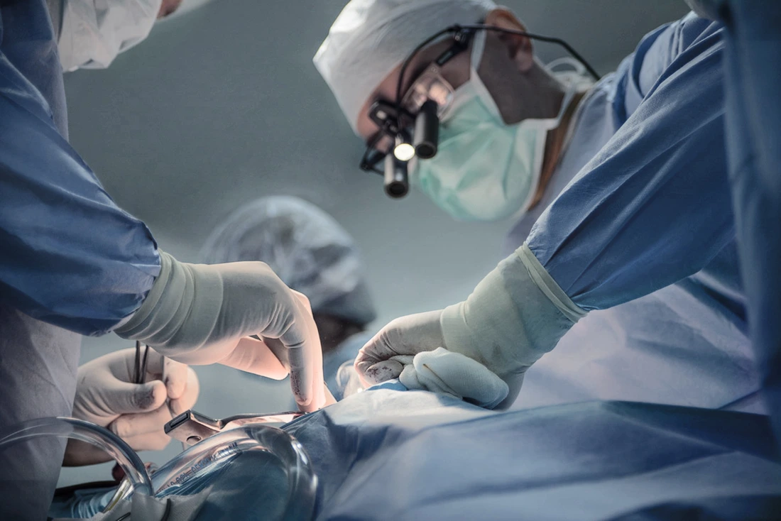 Doctors perform surgery cardiac stent transplant in a hospital